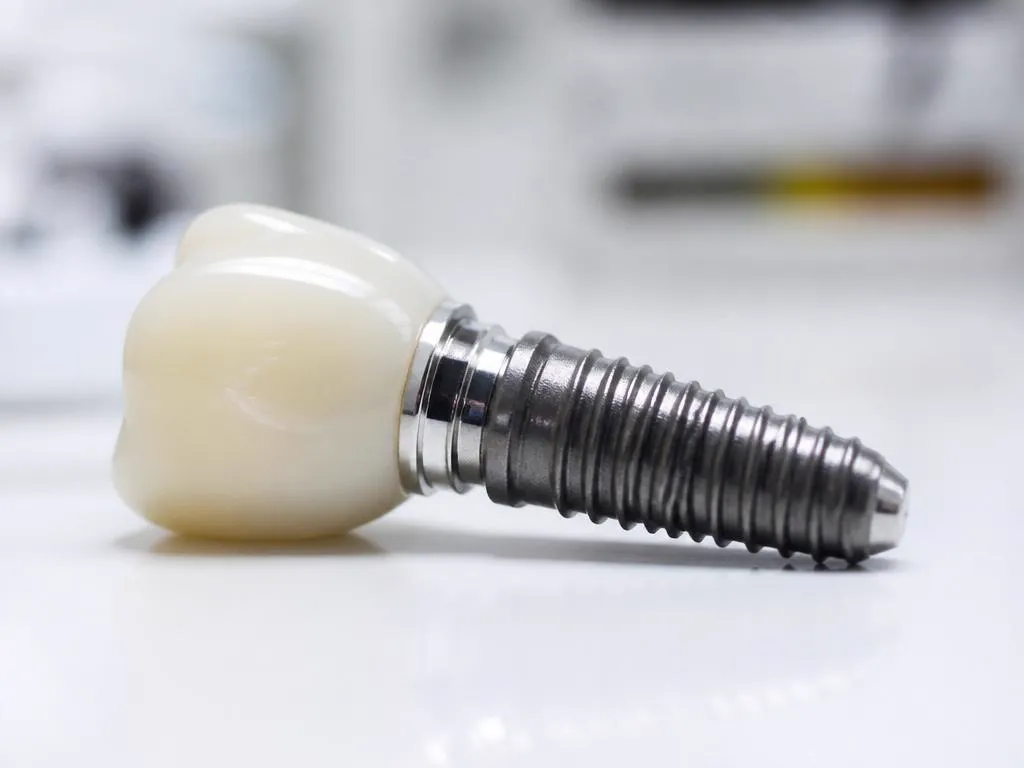 Implantes dentários