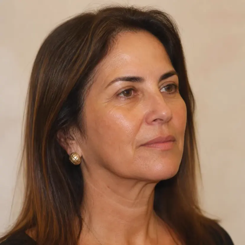 Lift facial em Guarulhos